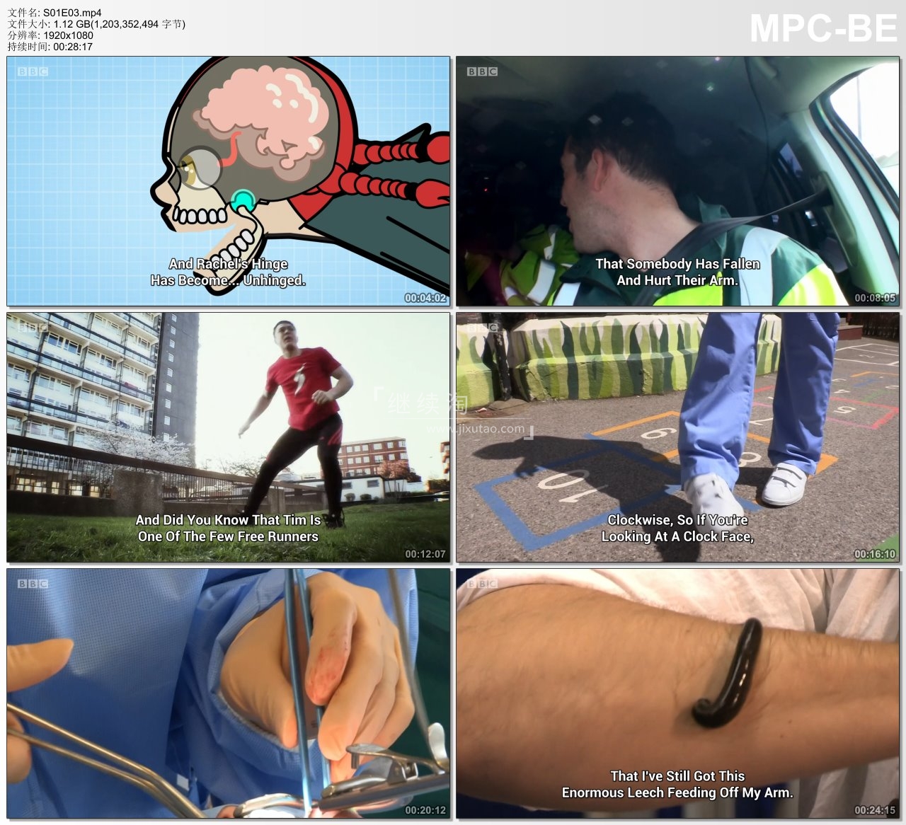 Operation Ouch 人体奥奇实验室 图片16 Operation Ouch 人体奥奇实验室 图片15